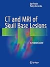 CT and MRI of Skull Base Lesions A Diagnostic Guide