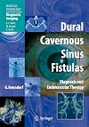 Dural cavernous sinus fistulas diagnosis and endovascular therapy