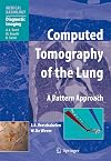 Computed Tomography of the Lung A Pattern Approach