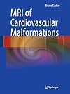 MRI of cardiovascular malformations