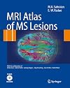 MRI Atlas of MS Lesions