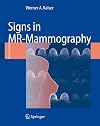 Signs in MR-Mammography