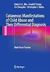 Cutaneous Manifestations of Child Abuse and Their Differential Diagnosis: Blunt Force Trauma