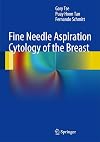 Fine needle aspiration cytology of the breast atlas of cyto-histologic correlates