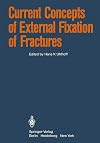 Current concepts of external fixation of fractures