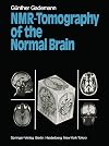 NMR-tomography of the normal brain