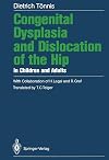 Congenital dysplasia and dislocation of the hip in children and adults