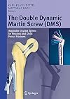 The Double Dynamic Martin Screw (DMS): Adjustable Implant System for Proximal and Distal Femur Fractures
