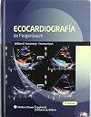 Ecocardiografía de Feigenbaum