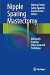 Nipple sparing mastectomy minimally invasive video-assisted technique