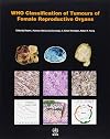 WHO Classification of Tumours of the Female Reproductive Organs (IARC WHO Classification of Tumours)