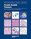 Female Genital Tumours: WHO Classification of Tumours (Medicine)