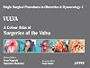 Colour Atlas of Surgeries of the Vulva (Volume 1) : A Colour Atlas of Surgeries of the Vulva