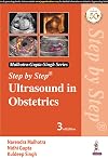 STEP BY STEP ULTRASOUND IN OBSTETRICs