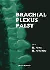 Brachial plexus palsy