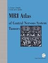 MRI atlas of central nervous system tumors