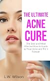 The Ultimate Acne Cure - The Best and Most Effective How to Guide to Treat Acne and Rid it Forever (acne no more, acne treatment, acne scar, acne cure, acne remedies, acne diet, pimples)