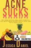 Acne Cure: The Acne Solution to Have Acne Free Skin for Life (Your Personal Acne Remedy Guide) (Self Help Book 5)