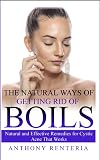 The Natural Ways of Getting Rid of Boils: Natural and Effective Remedies for Cystic Acne that Works