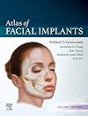 Atlas of facial implants